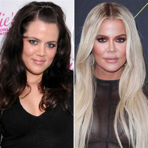 khloe before and after pics.